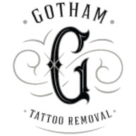 Gotham Tattoo Removal